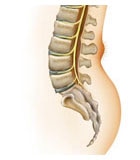 Spina bifida occulta 